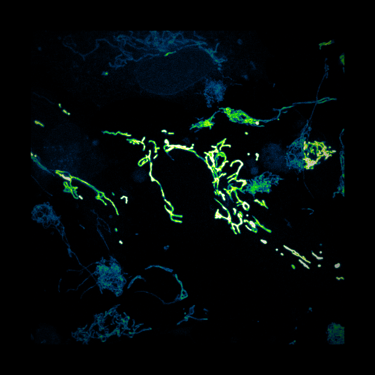Gut-brain visual
